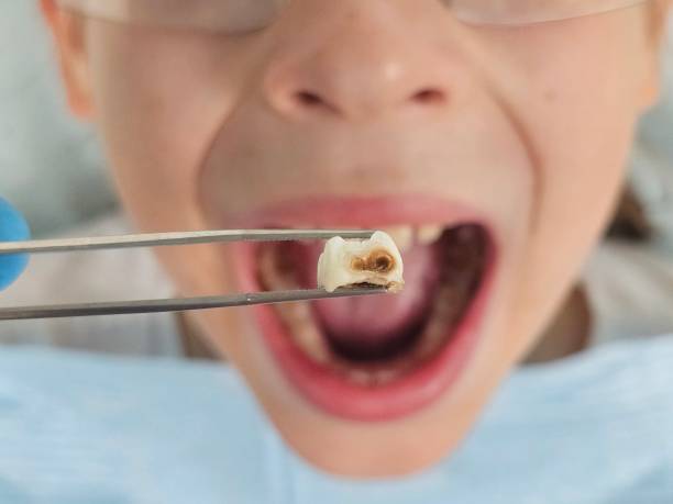 Best Emergency Pediatric Dentist  in Colony Rk, PA